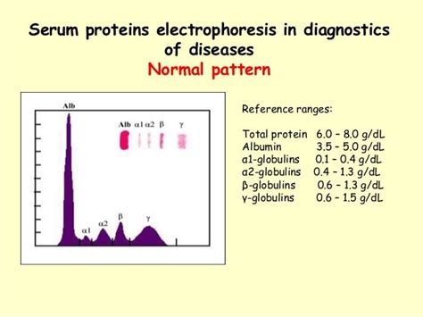 Understanding and Interpreting Serum Protein Electrophoresis .
